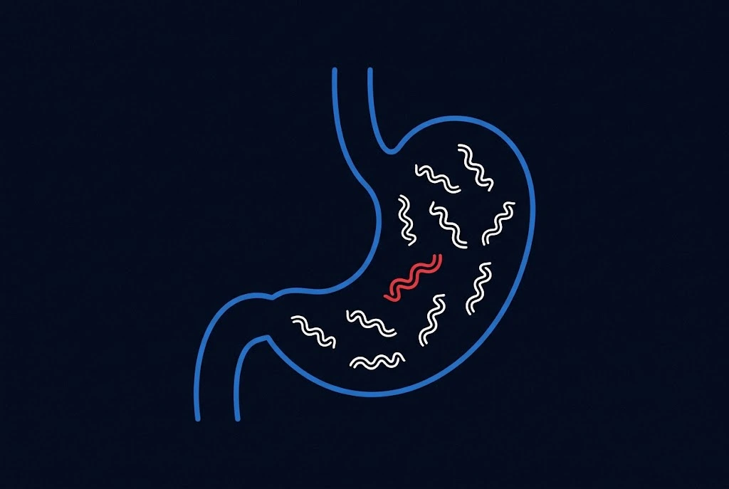 Outline of a stomach containing spiral-shaped H. pylori bacteria, one highlighted in red